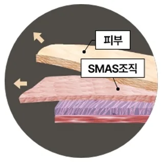 안면거상 SMAS 근막층
