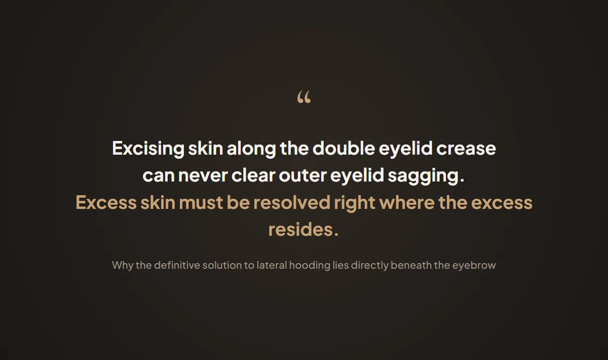 Excising skin at the double eyelid crease can never adequately resolve outer eyelid sagging