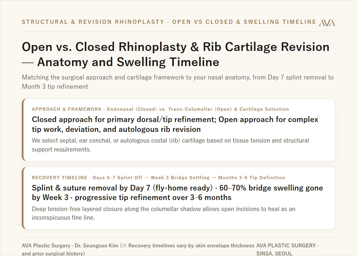 Open vs Closed Rhinoplasty, Rib Cartilage Framework, and Swelling Timeline Summary Card