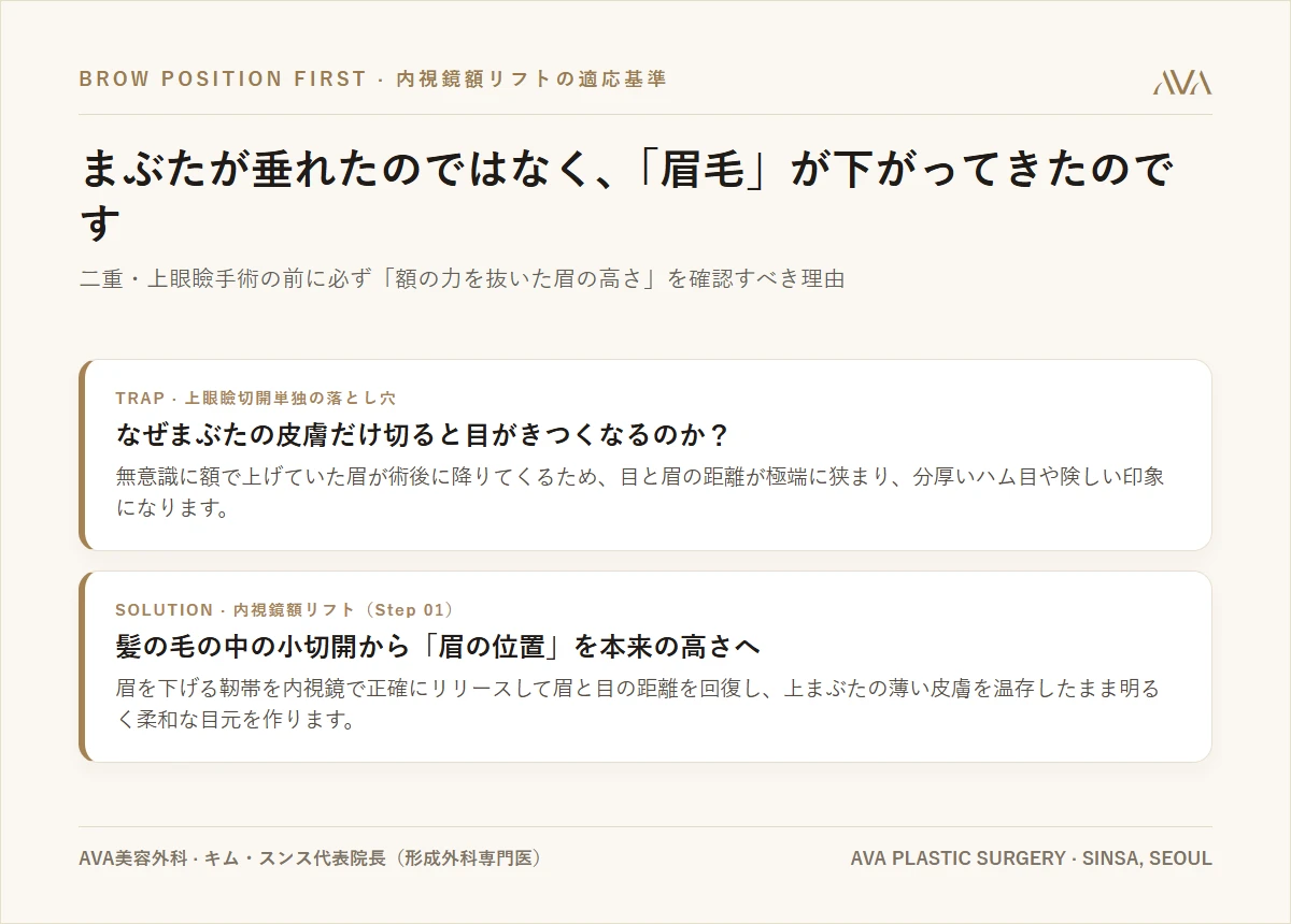 内視鏡額リフト — まぶたが垂れたのではなく、「眉毛」が下がってきたのです