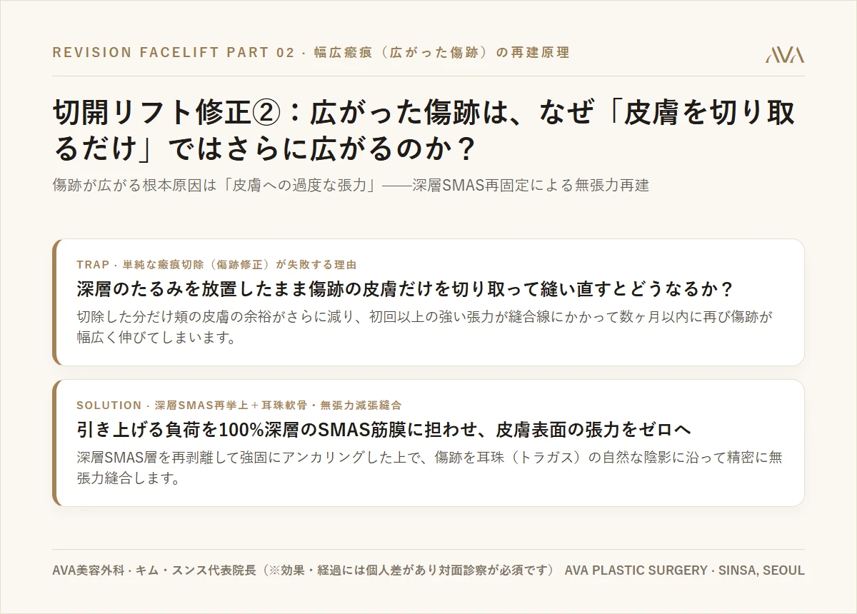 切開リフト修正②：広がった傷跡は、なぜ「傷跡を切り取って縫い直すだけ」ではさらに広がるのか？