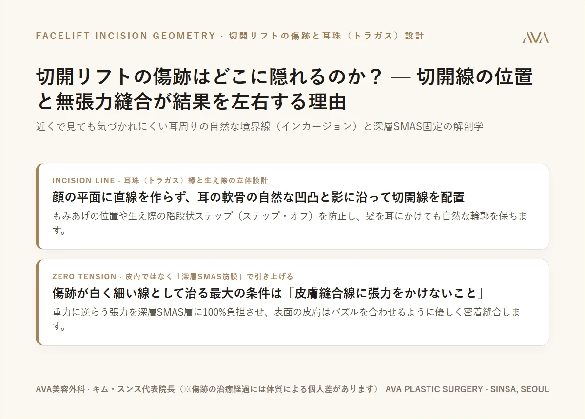 切開リフト（顔面挙上）の傷あとはなぜ「切開線の位置」で決まるのか？ — 生え際・耳珠（トラガス）の解剖学