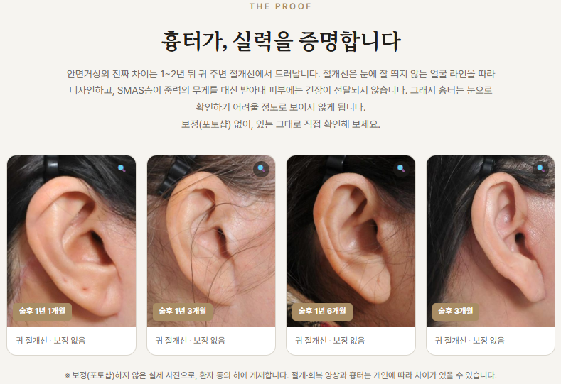 원문에 실린 귀 주변 절개선 경과 사진