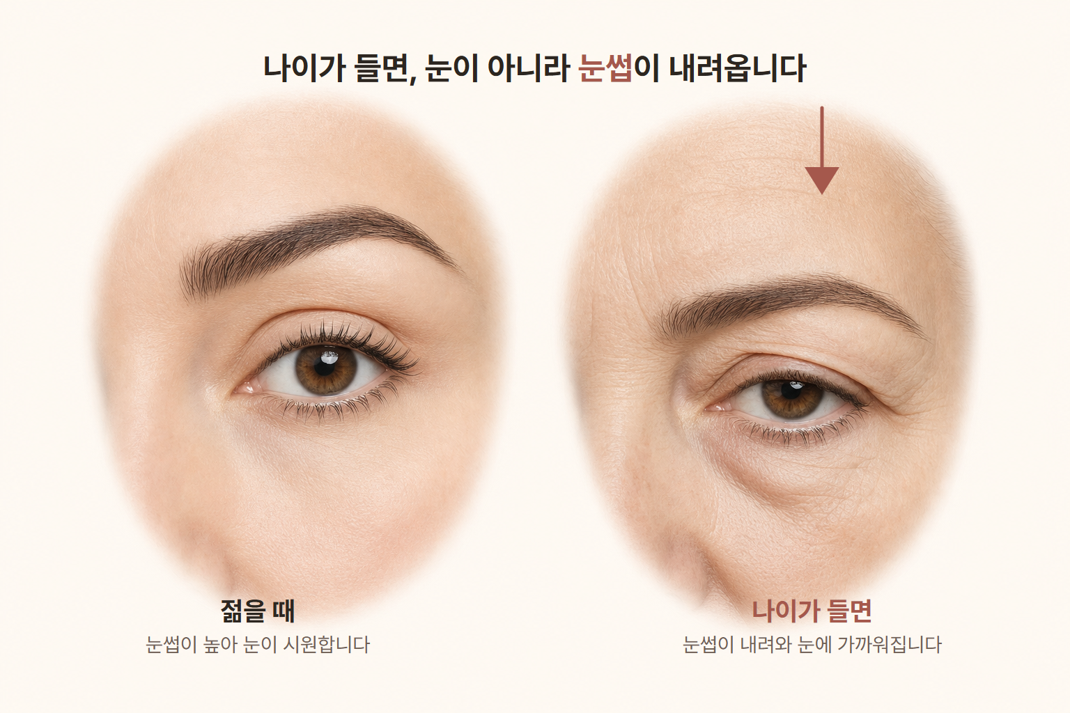 이마거상 — 눈이 처진 게 아니라, 눈썹이 내려온 겁니다 — 원문 이미지 2
