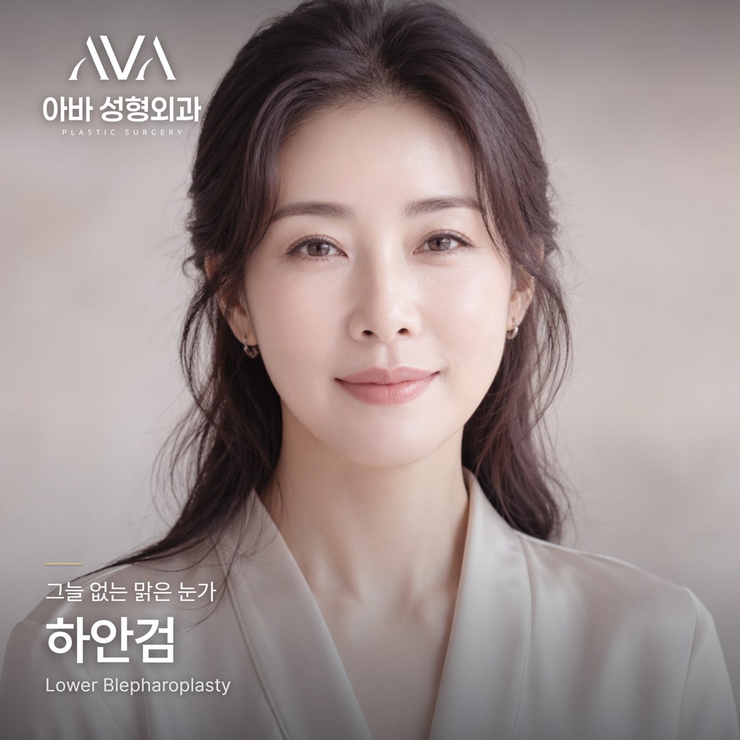 하안검 vs 눈밑지방재배치 — 나는 어떤 눈밑 수술? '30대 중반'이 분기점입니다 — 원문 이미지 4