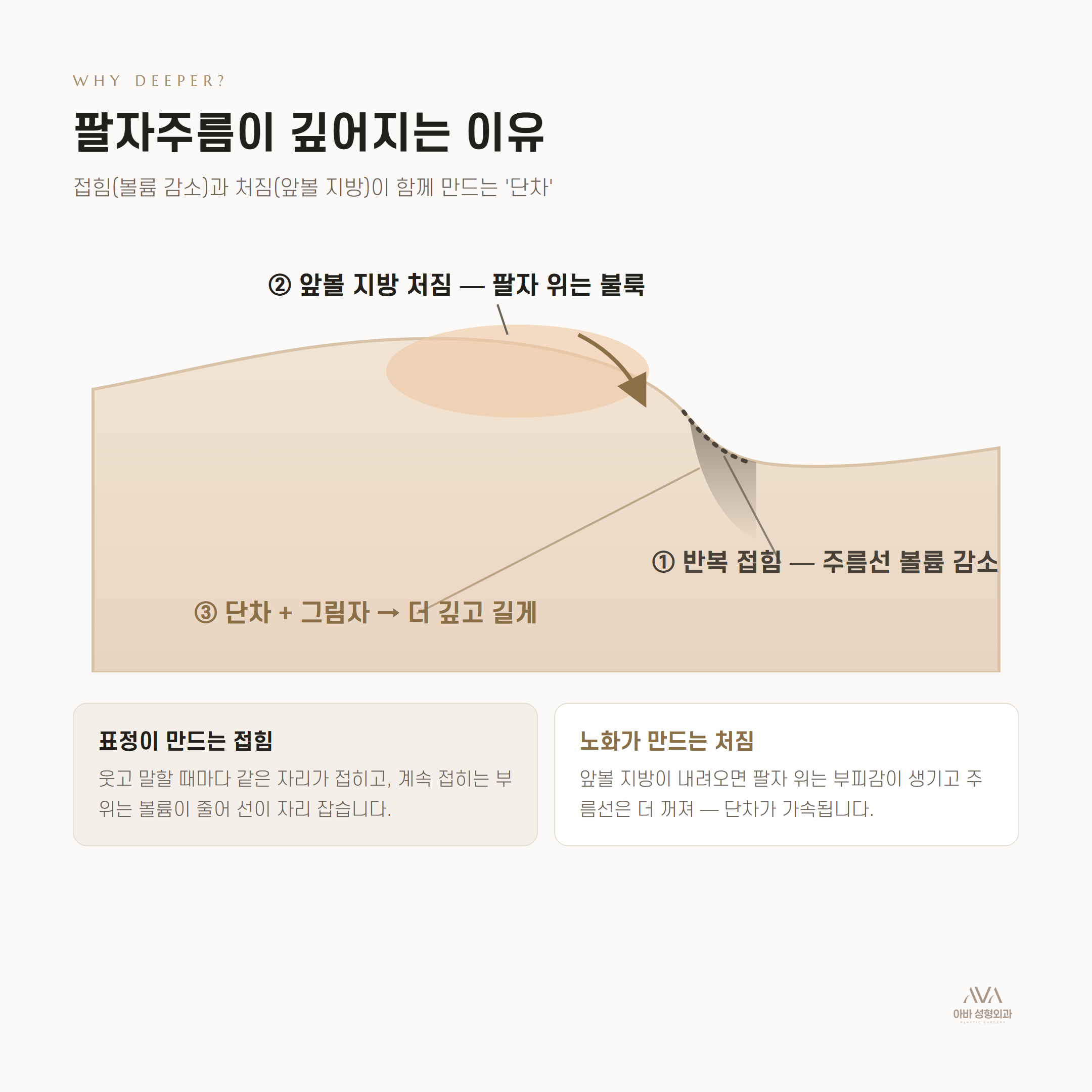 팔자주름 — 필러로 채울까, 리프팅으로 되돌릴까 — 원문 이미지 2