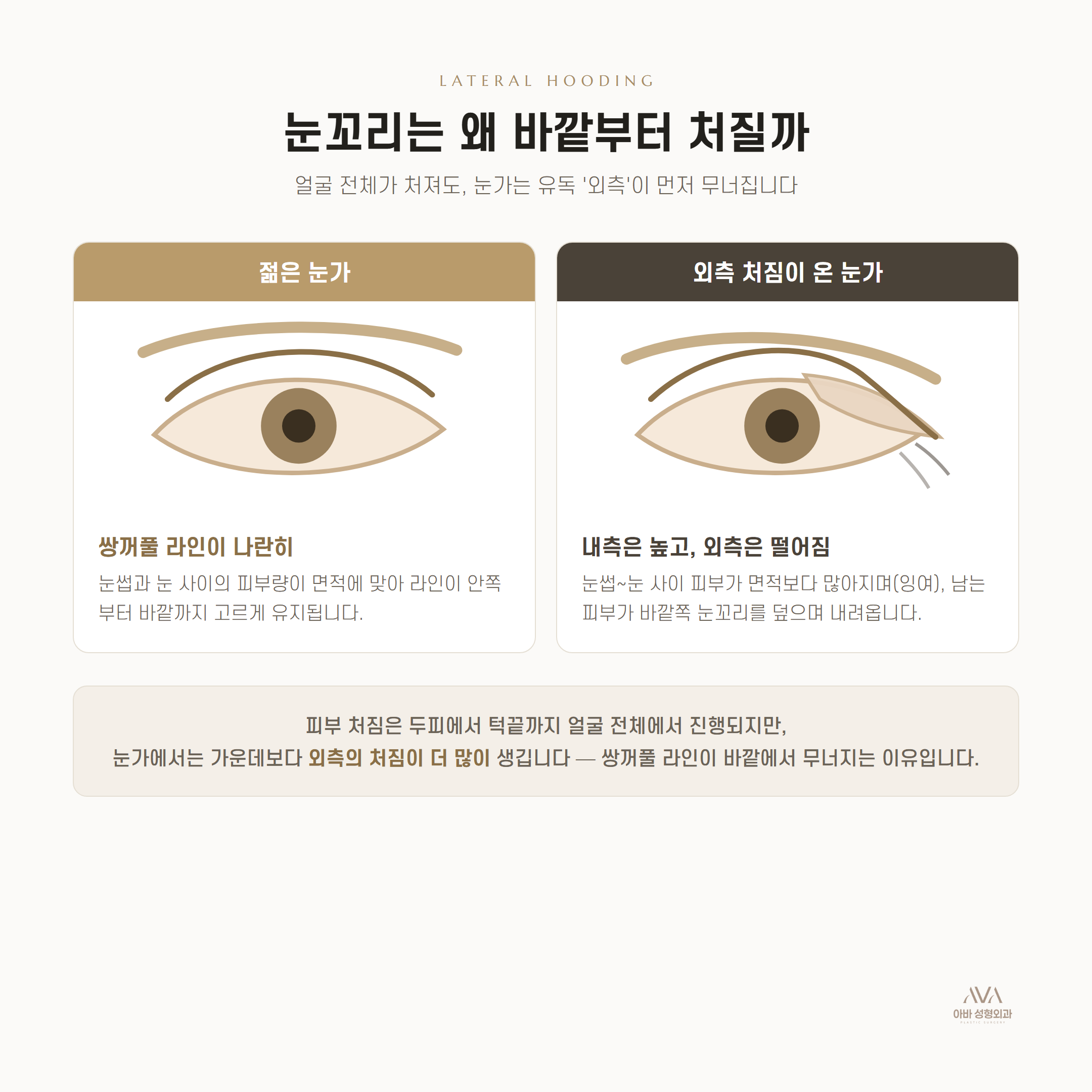 눈은 왜 바깥쪽부터 처질까 — 외측 눈꼬리 처짐과 눈썹하거상 — 원문 이미지 2