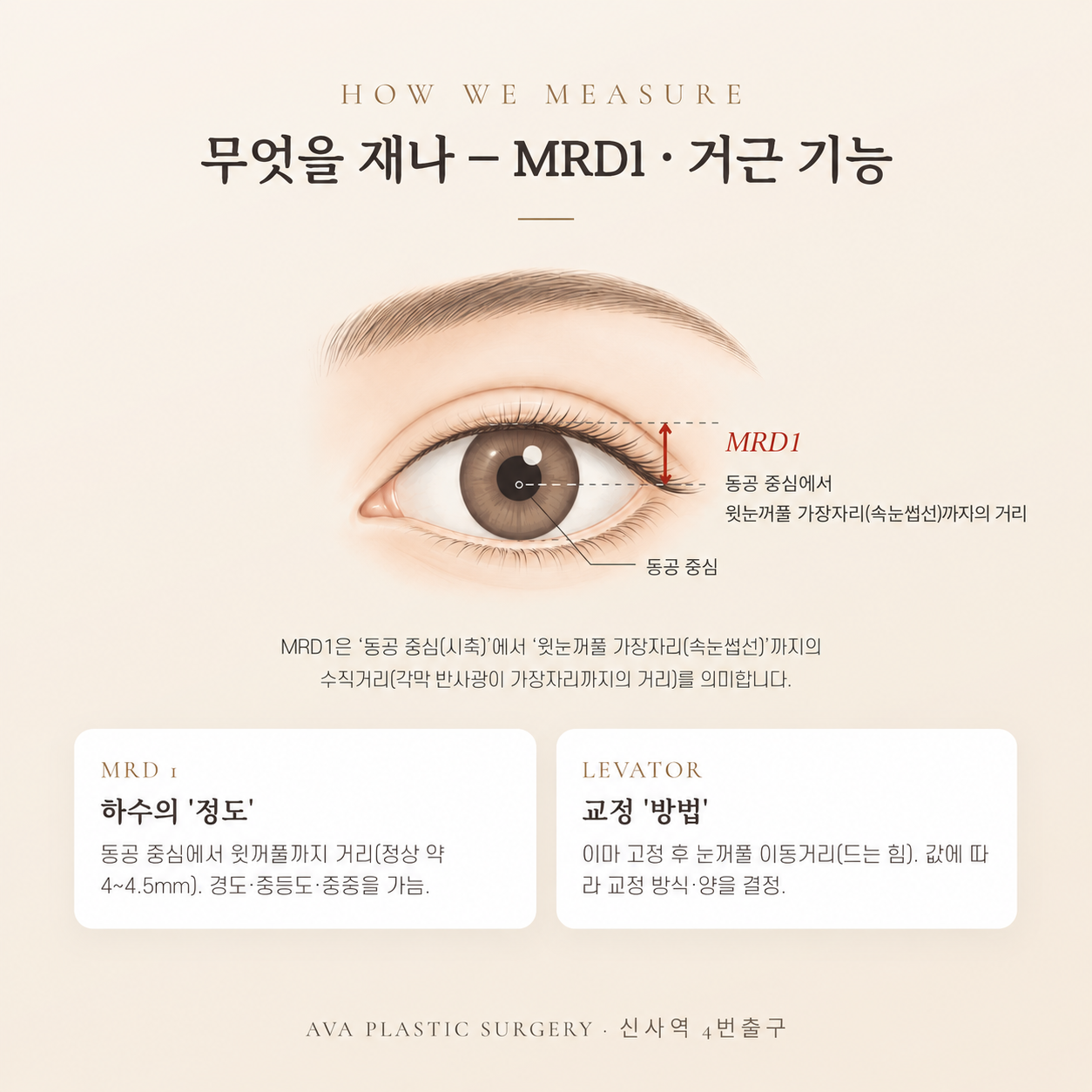 안검하수 자가진단·측정법 — 눈꺼풀 처짐, 어떻게 재고 언제 교정할까 — 원문 이미지 4