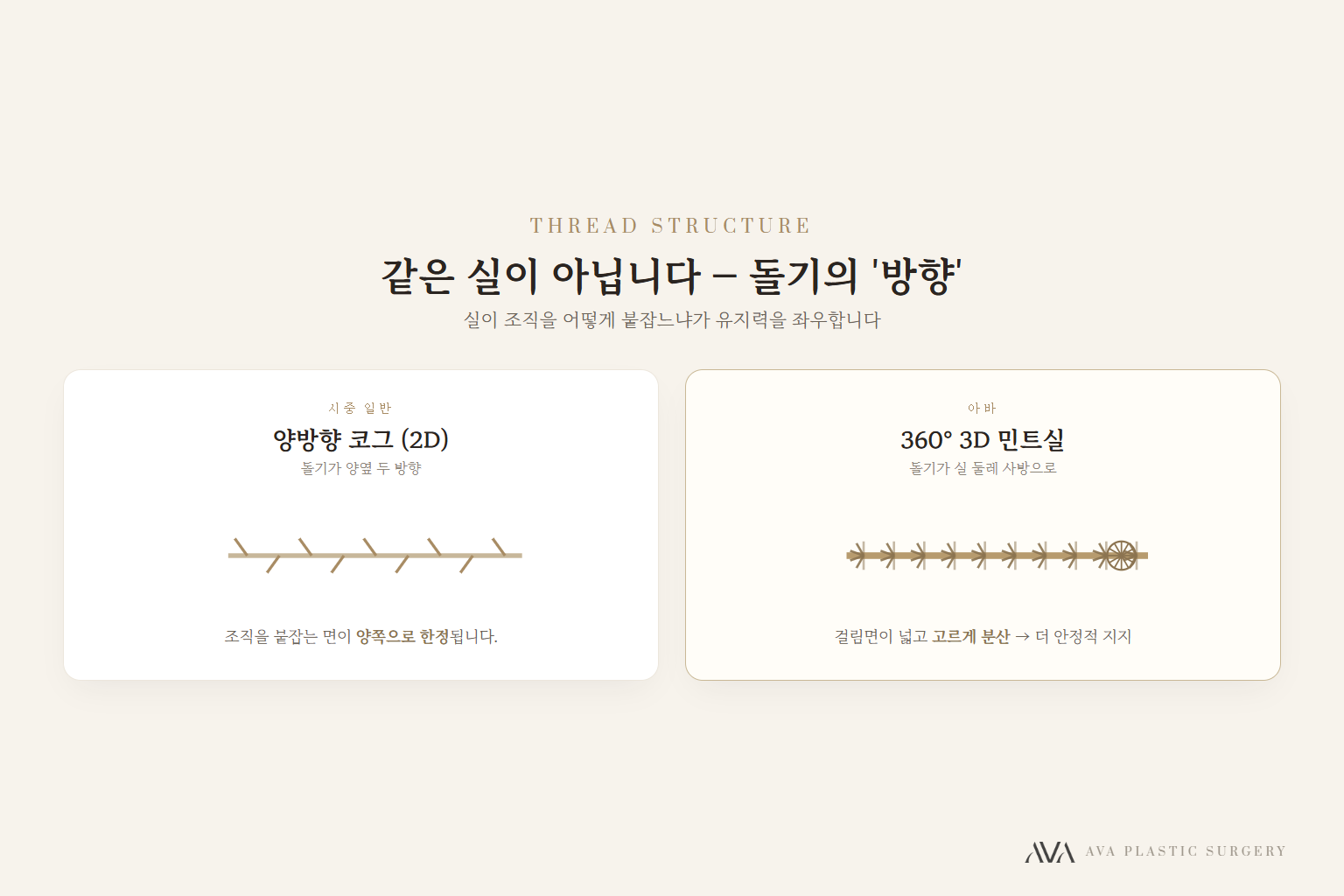 실리프팅, '얼마나 오래가느냐'는 두 가지가 결정합니다 — 원문 이미지 2
