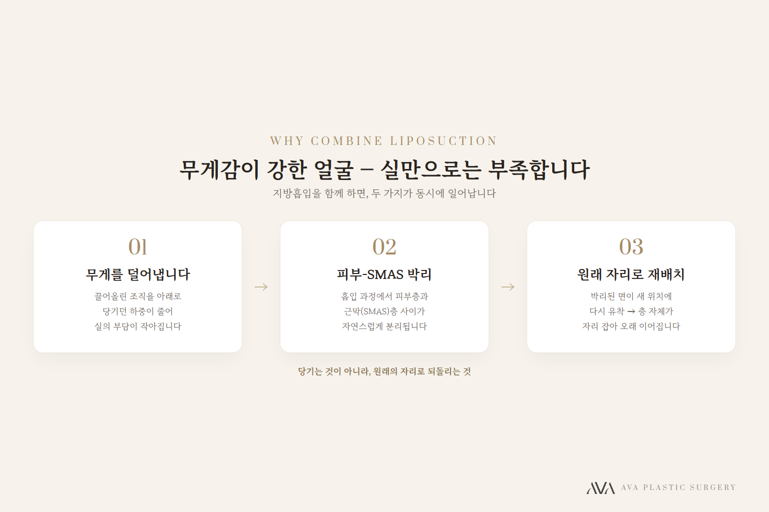 실리프팅, '얼마나 오래가느냐'는 두 가지가 결정합니다 — 원문 이미지 4