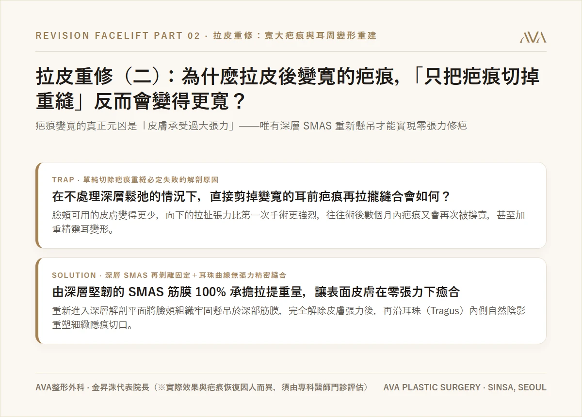 拉皮重修（二）：為什麼拉皮後變寬的疤痕，「只把疤痕切掉重縫」反而會變得更寬？