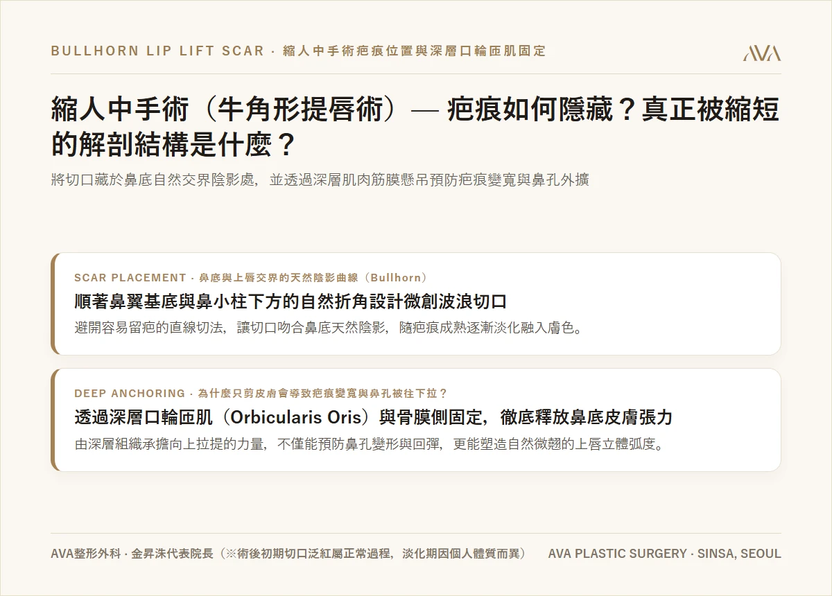 縮人中手術（Bullhorn 提唇術）的疤痕藏在哪裡？ — 鼻底天然陰影切口與深層口輪匝肌固定