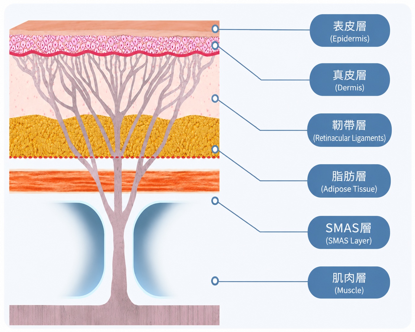 臉部SMAS筋膜層